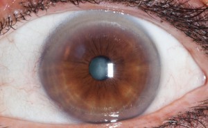 auge-titel-1-von-1-7